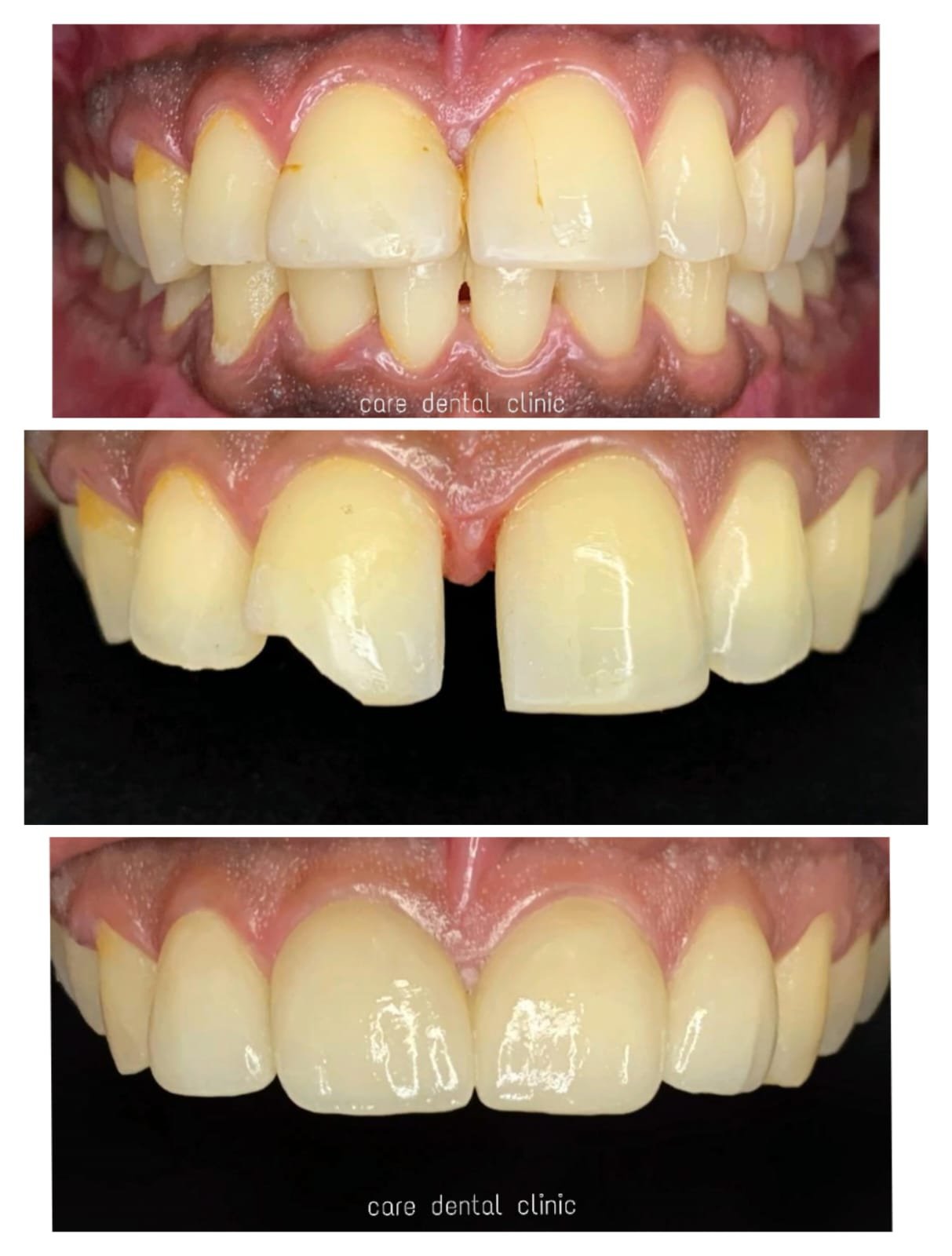 Smile transformation 2