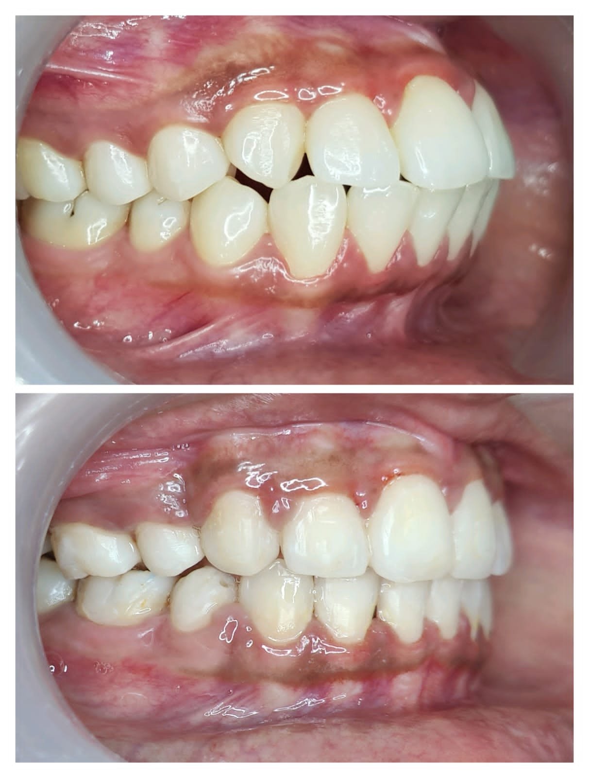 Smile transformation 4