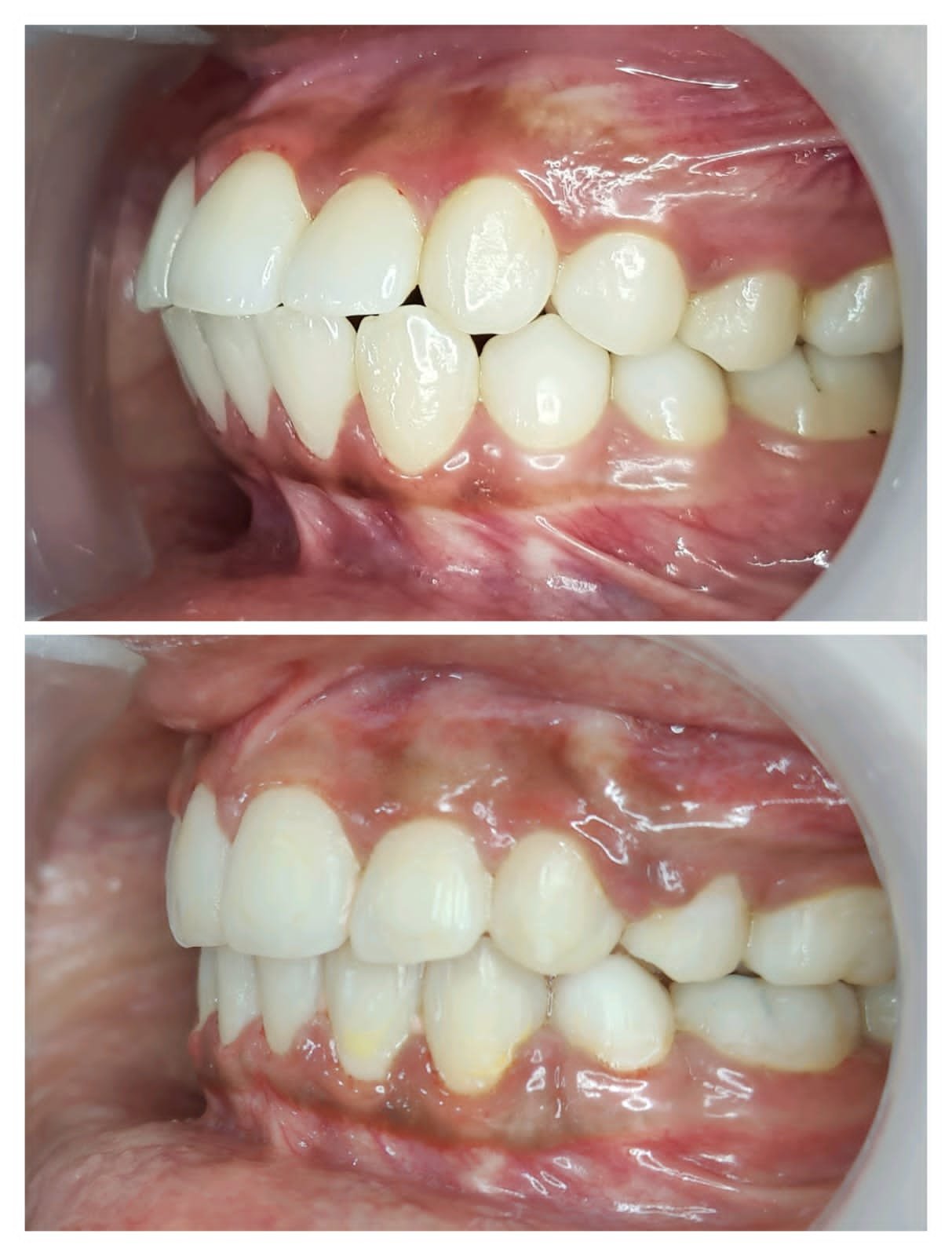 Smile transformation 5