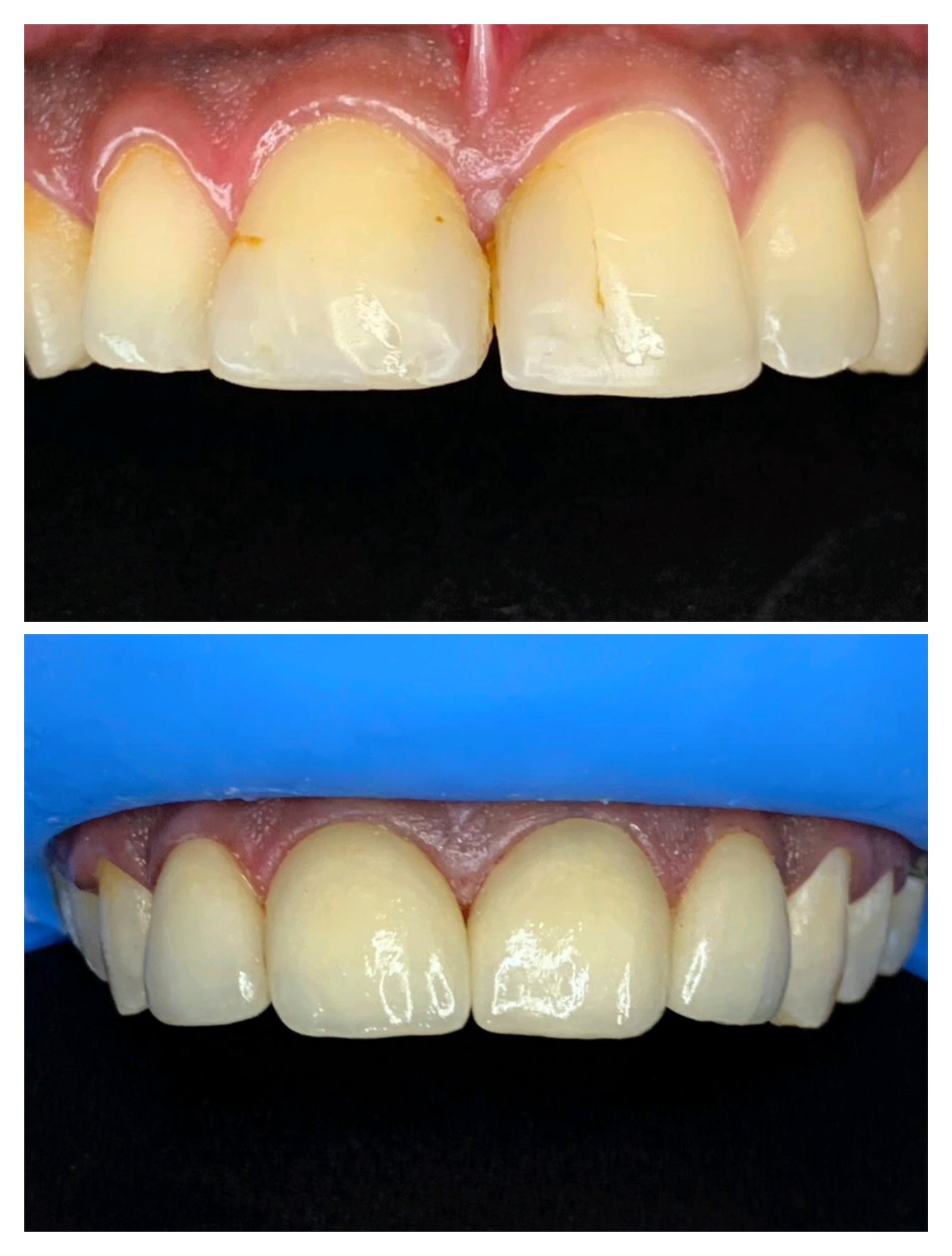 Smile transformation 7