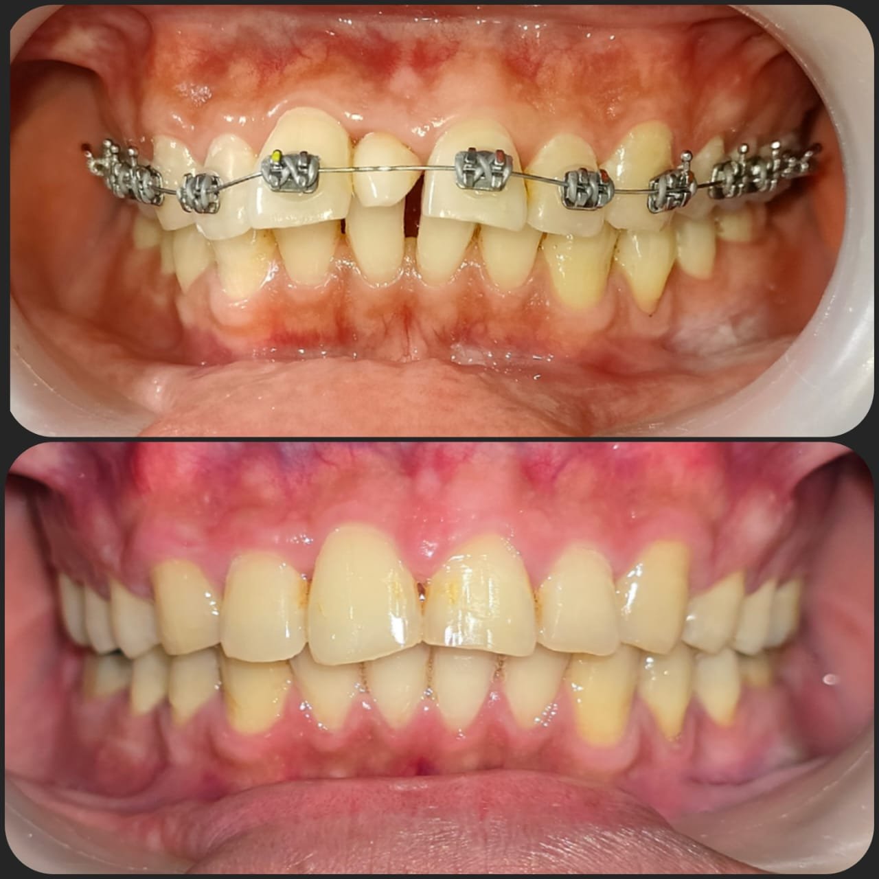 Smile transformation 10