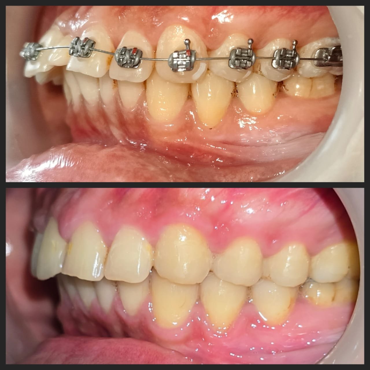 Smile transformation 11