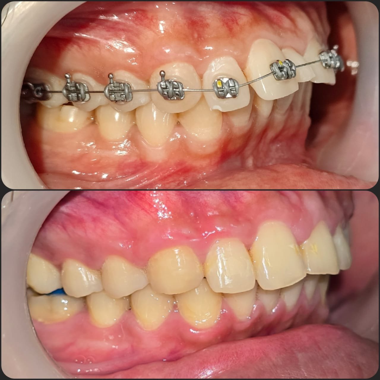 Smile transformation 12