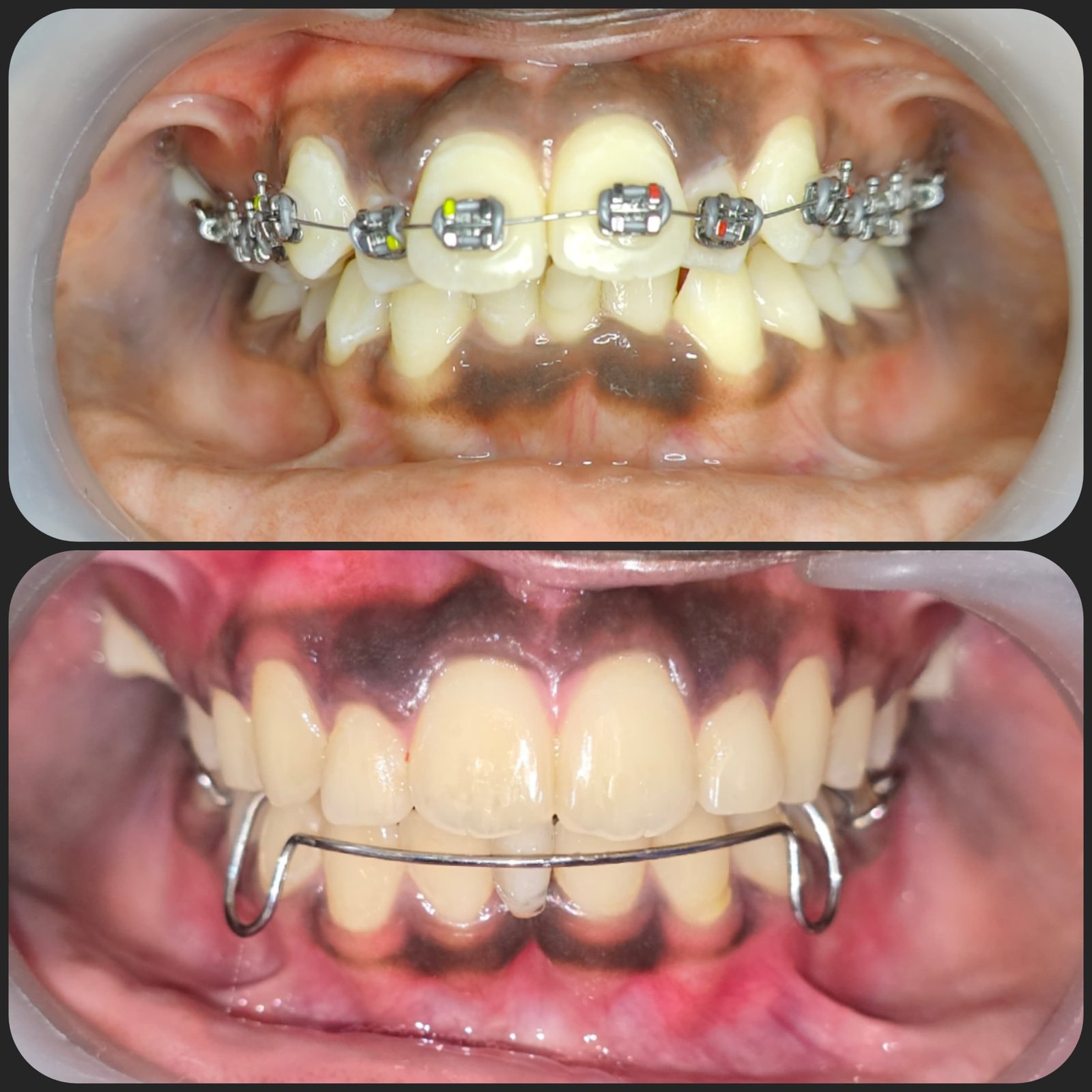 Smile transformation 13