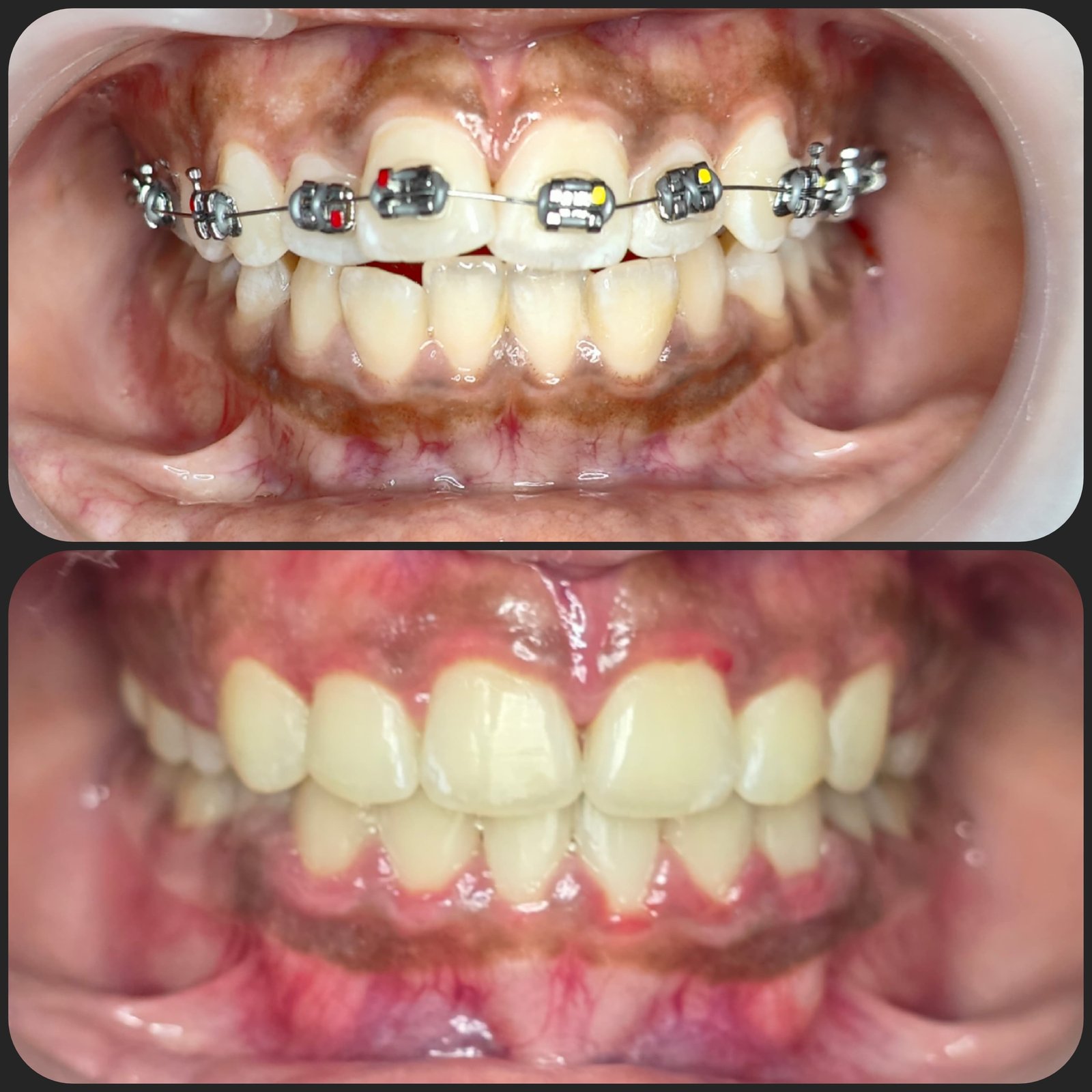 Smile transformation 15