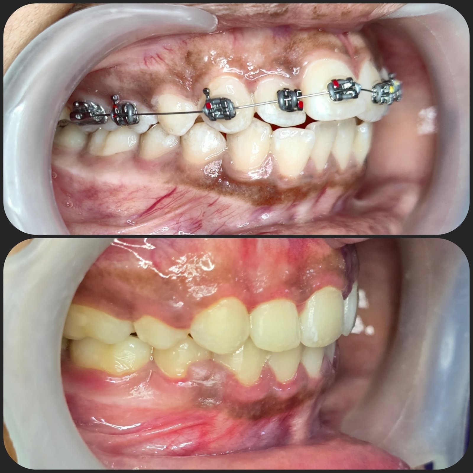 Smile transformation 16