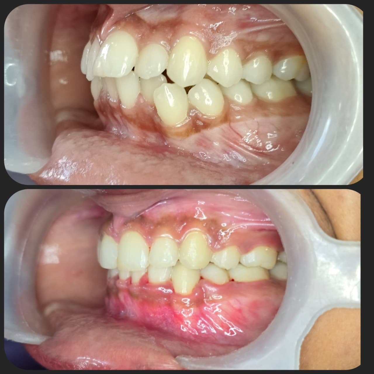 Smile transformation 18