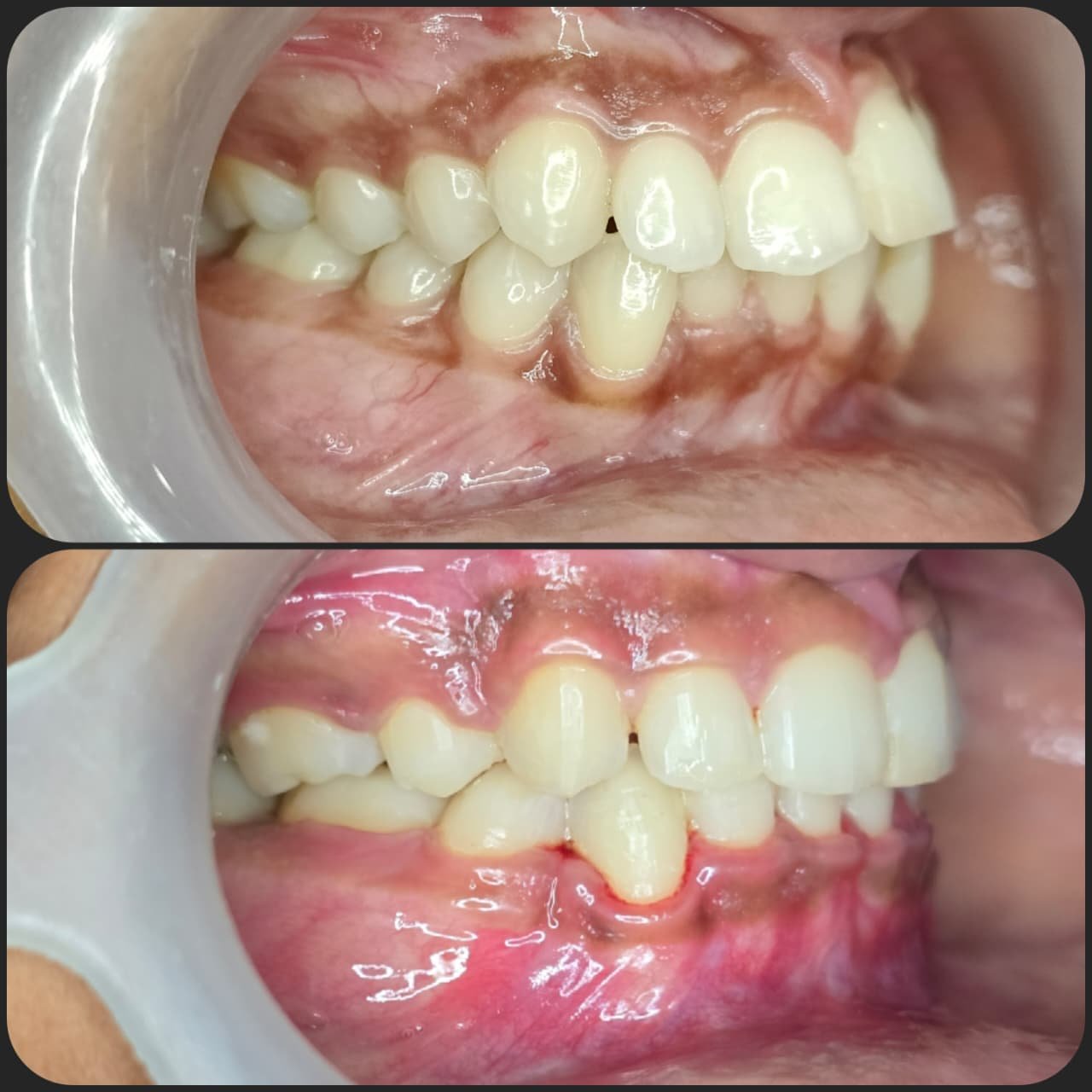 Smile transformation 19