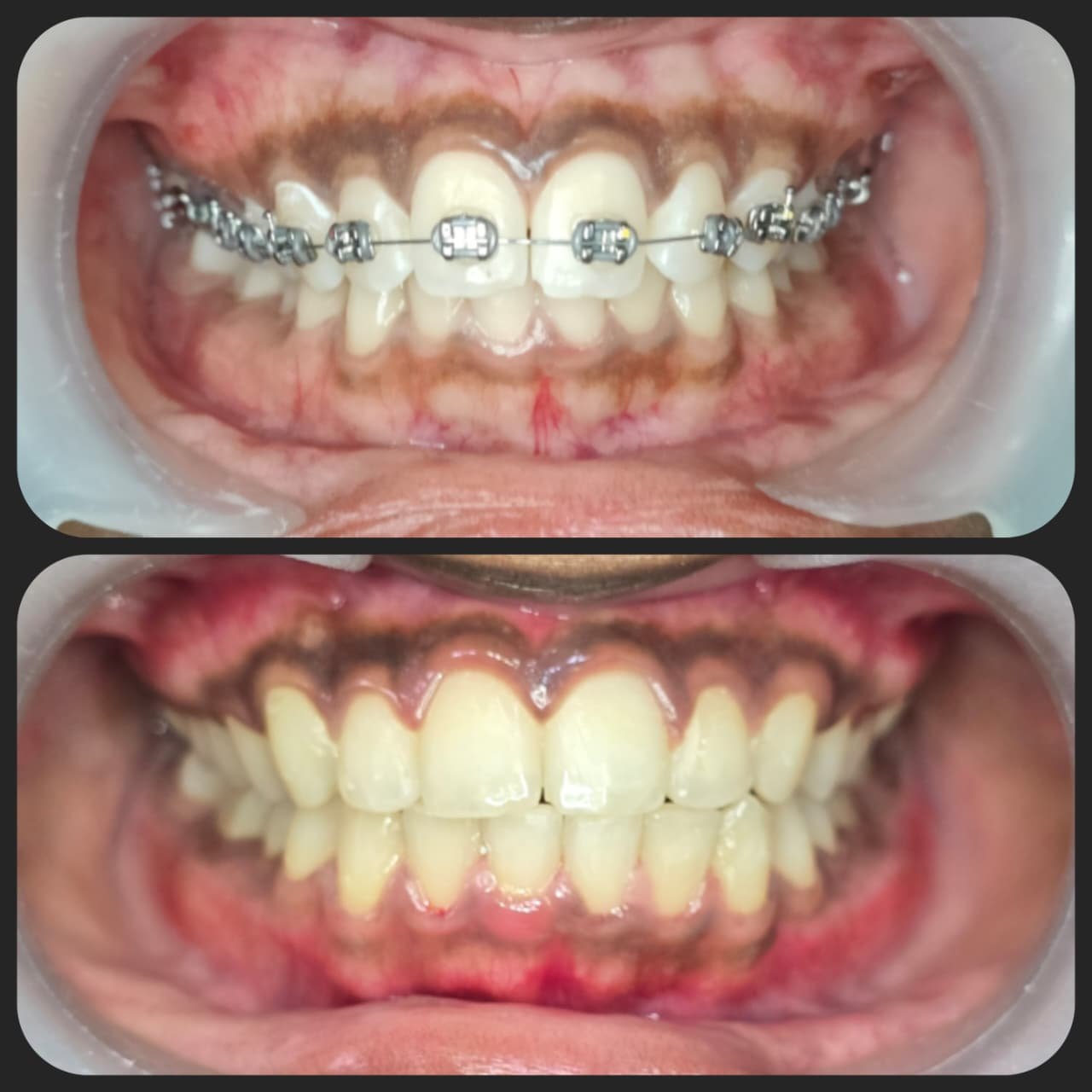 Smile transformation 20
