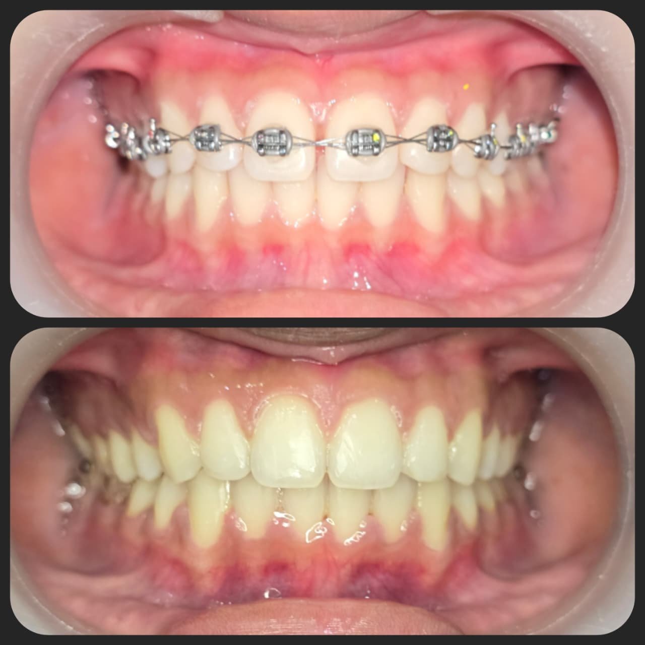 Smile transformation 21