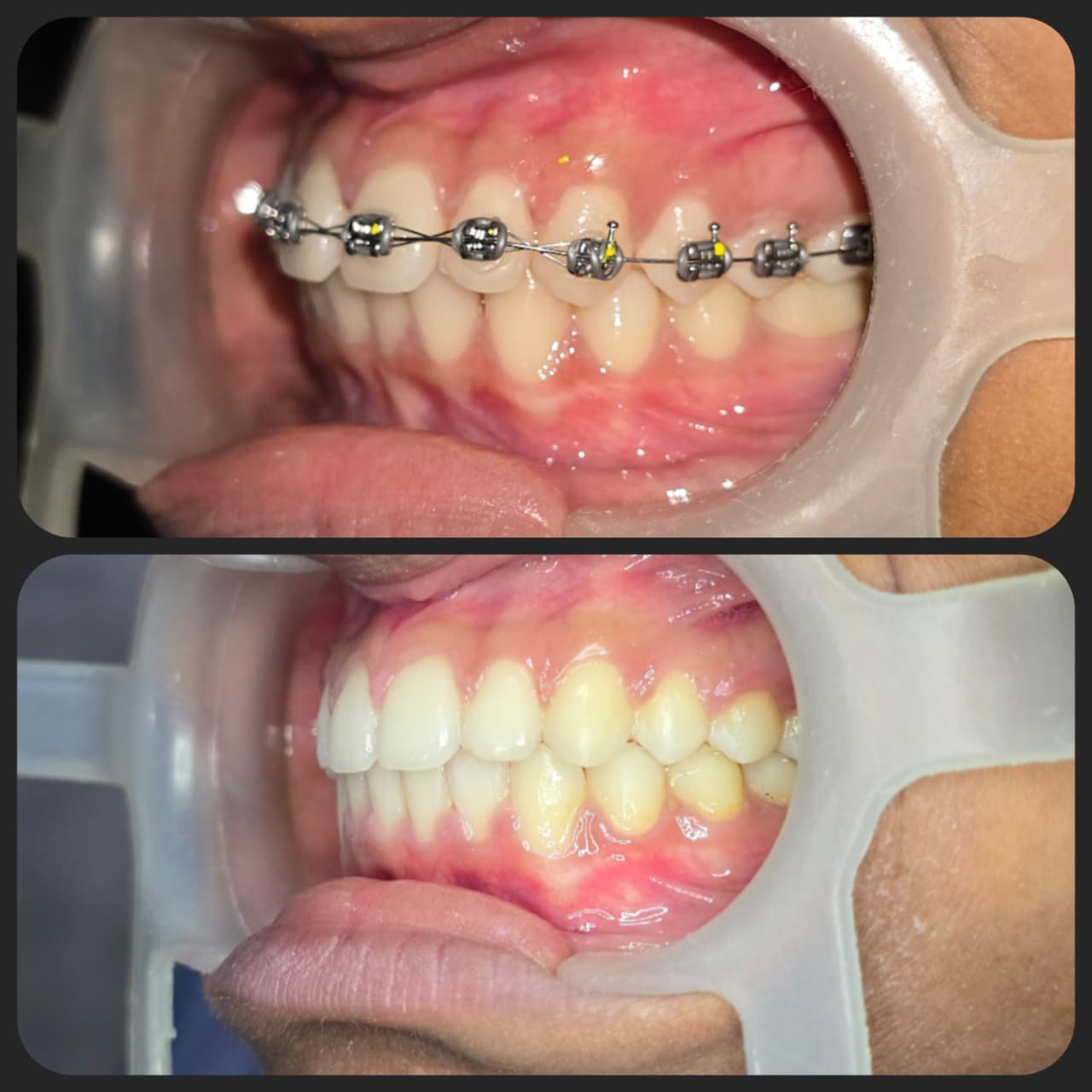 Smile transformation 22