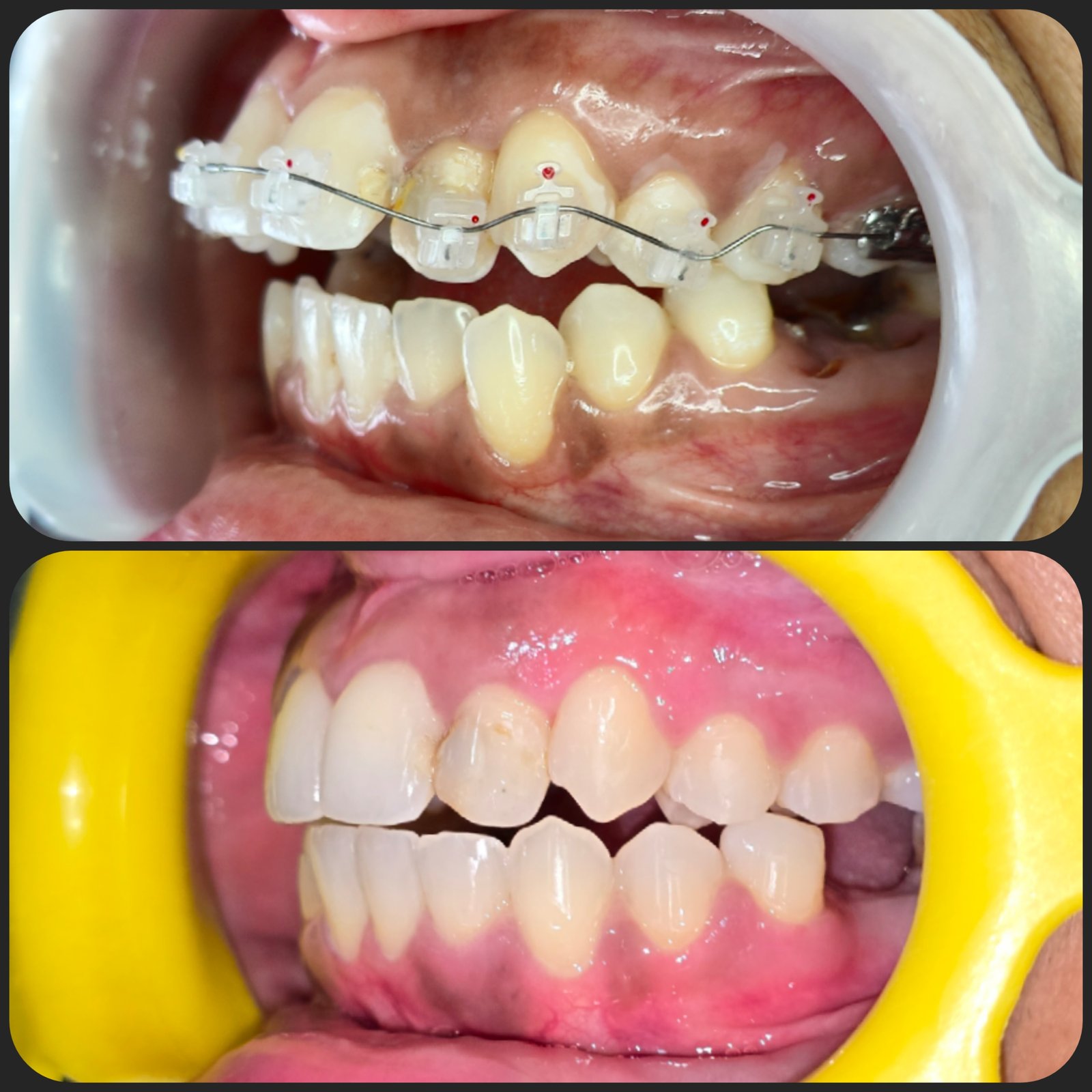 Smile transformation 24