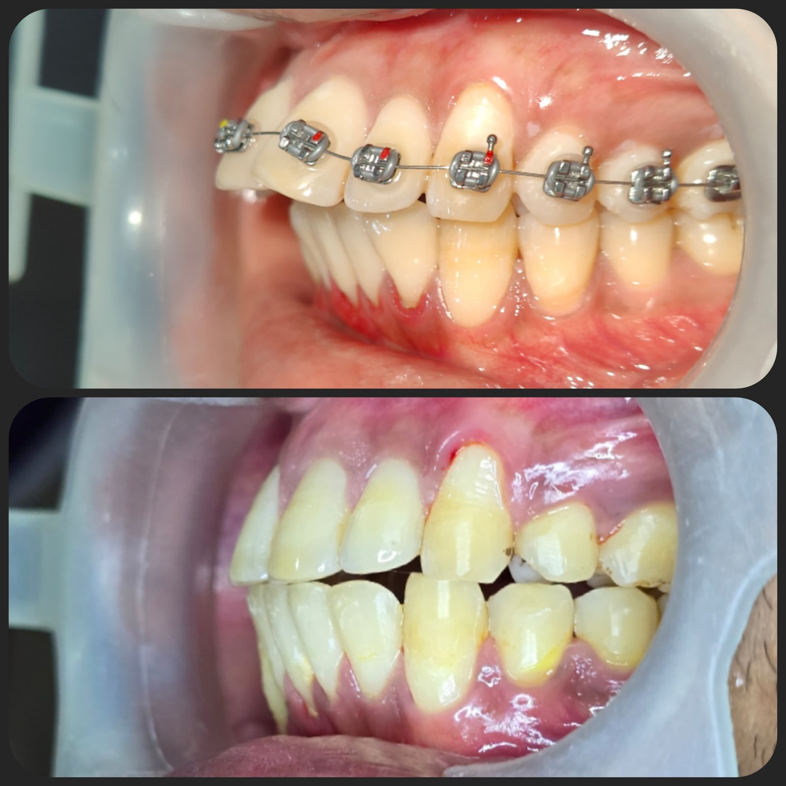Smile transformation 25