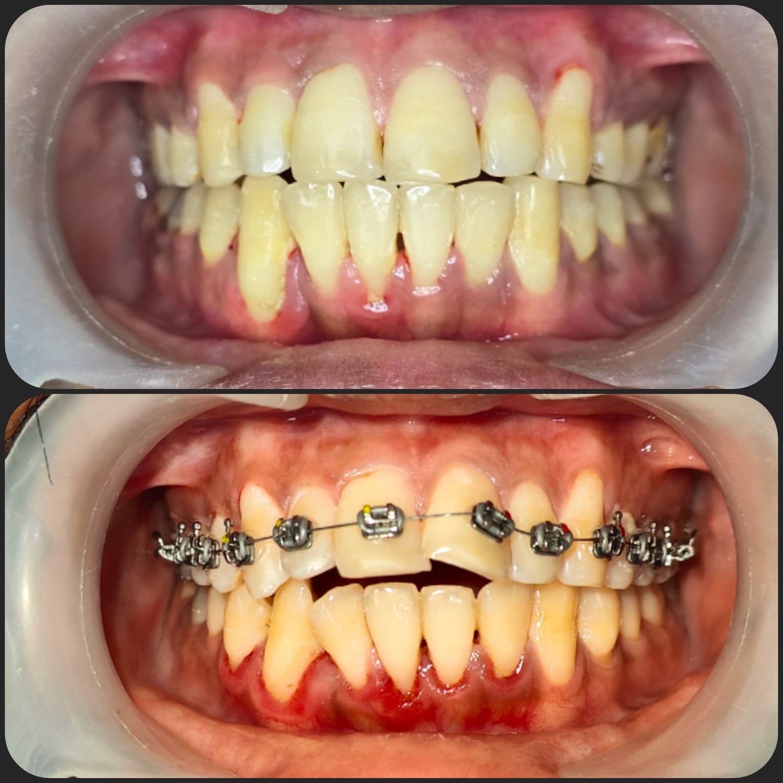 Smile transformation 26
