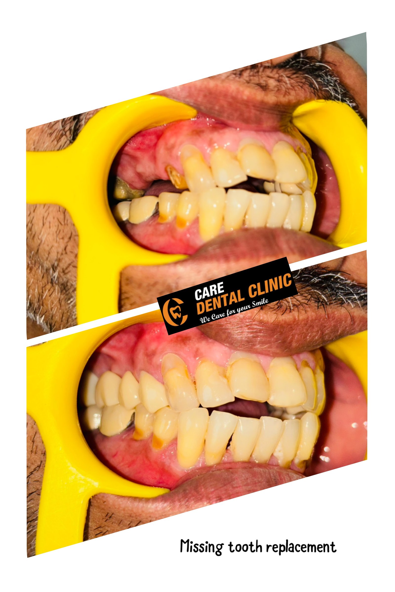 Smile transformation 27