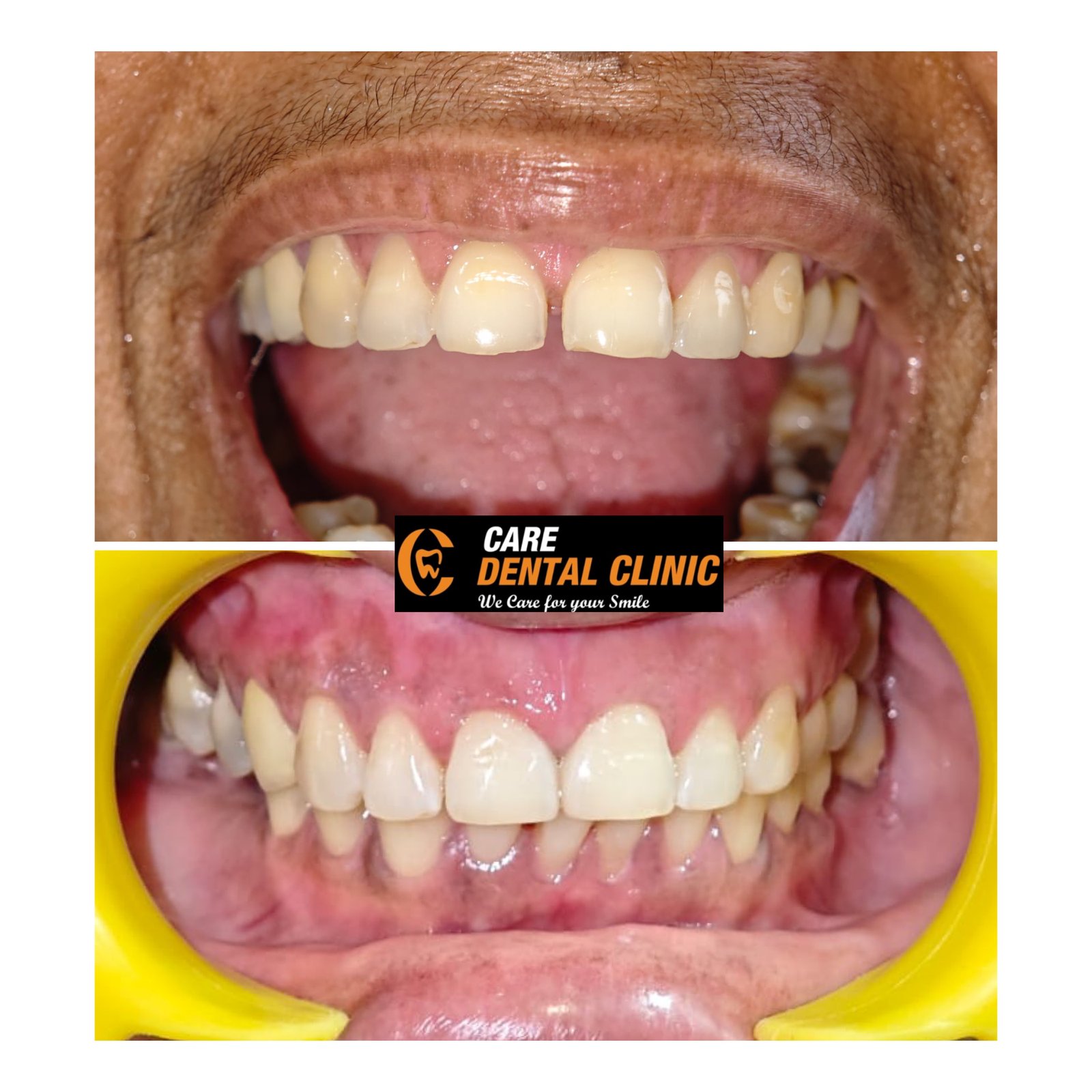 Smile transformation 28