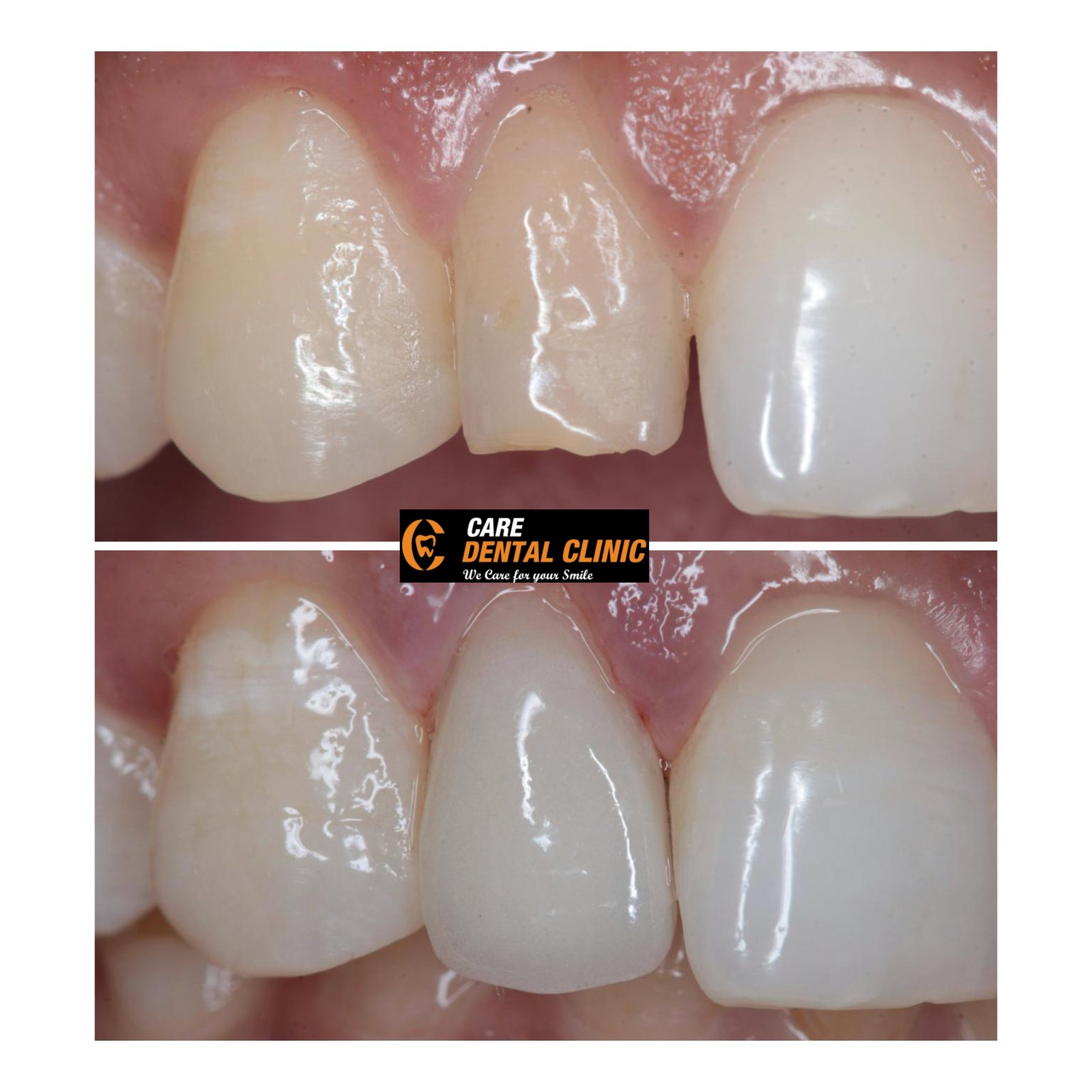 Smile transformation 29
