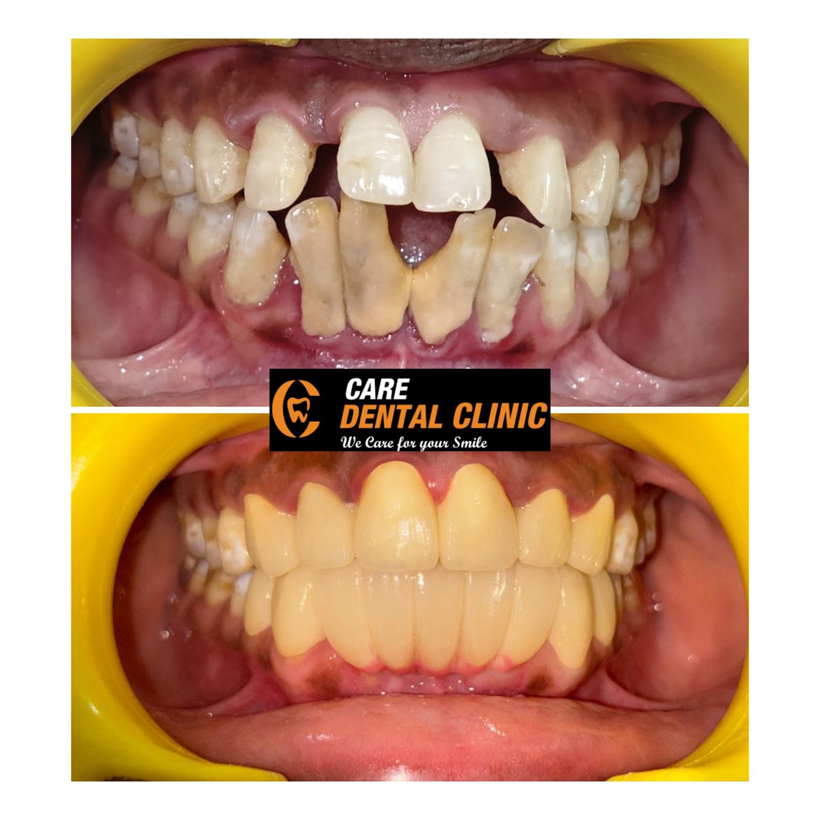 Smile transformation 30